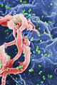 Link a Conferenza Mondiale AIDS: le terapie riducono le nuove infezioni